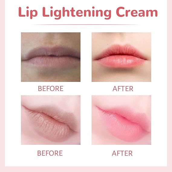 Lips Bleaching Cream Balm